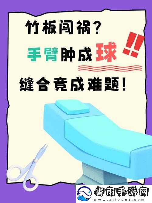 竹板打肿臂缝合不上-后续处理引争议