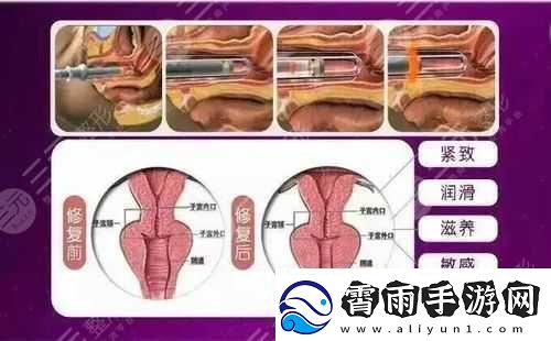欧洲之星私密紧致