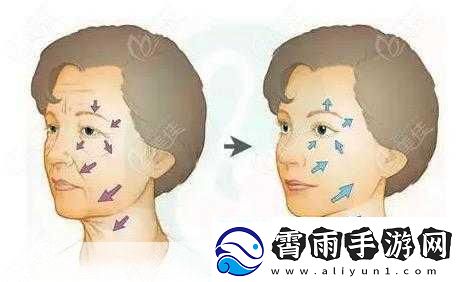 八爪鱼紧缩术