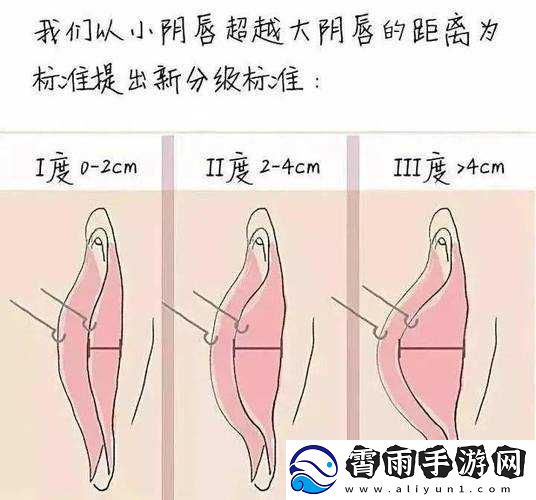阴脣肥大图示蝴蝶的独特之美