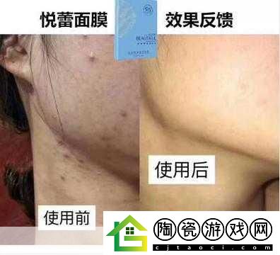一面膜上边一面膜下边韩国