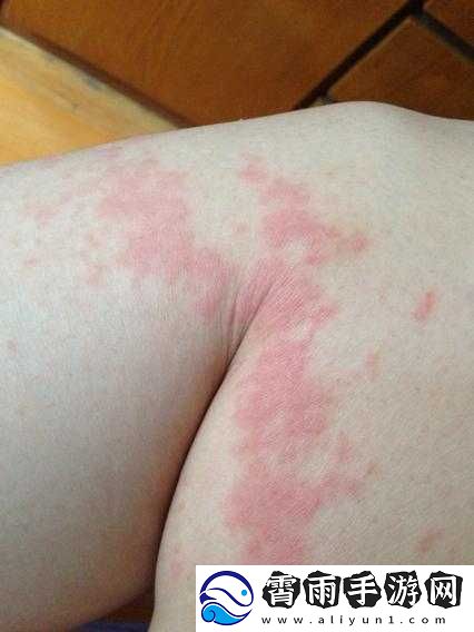 女生打扑克时腿迈开又疼又痒的经历