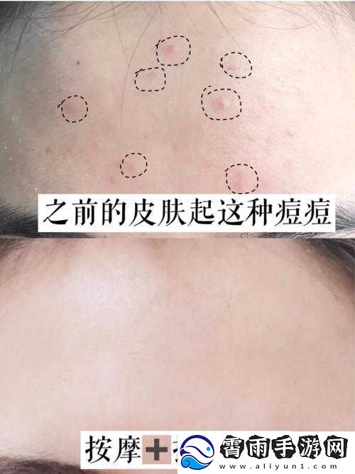 老中医为小雨排阴毒：揭秘真相
