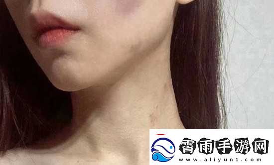红雅典娜LIYA死了吗